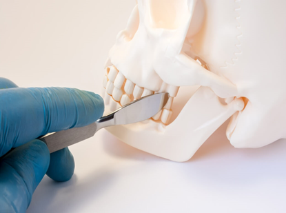 Jaw Surgery, Trauma Surgery, Orthognathic Surgery, Cyst and Tumor Surgery, Implant Surgery, Periodontal Treatment, Prosthetic Dentistry, Gum Diseases, Implant, Prostheses, Aesthetic Dentistry, Teeth Whitening, Sedation, Botox, TMJ Diseases, Tooth Extraction, Apical Resection, Impacted Tooth Surgery