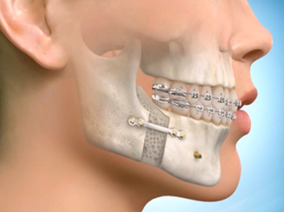 Jaw Surgery, Trauma Surgery, Orthognathic Surgery, Cyst and Tumor Surgery, Implant Surgery, Periodontal Treatment, Prosthetic Dentistry, Gum Diseases, Implant, Prostheses, Aesthetic Dentistry, Teeth Whitening, Sedation, Botox, TMJ Diseases, Tooth Extraction, Apical Resection, Impacted Tooth Surgery
