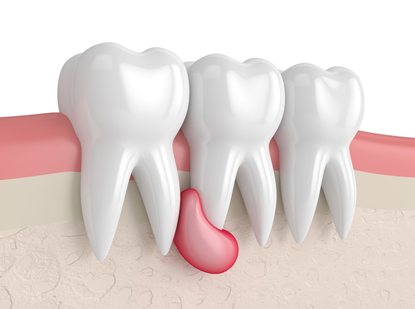 Jaw Surgery, Trauma Surgery, Orthognathic Surgery, Cyst and Tumor Surgery, Implant Surgery, Periodontal Treatment, Prosthetic Dentistry, Gum Diseases, Implant, Prostheses, Aesthetic Dentistry, Teeth Whitening, Sedation, Botox, TMJ Diseases, Tooth Extraction, Apical Resection, Impacted Tooth Surgery